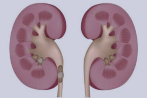 Kidney Stone Prevention